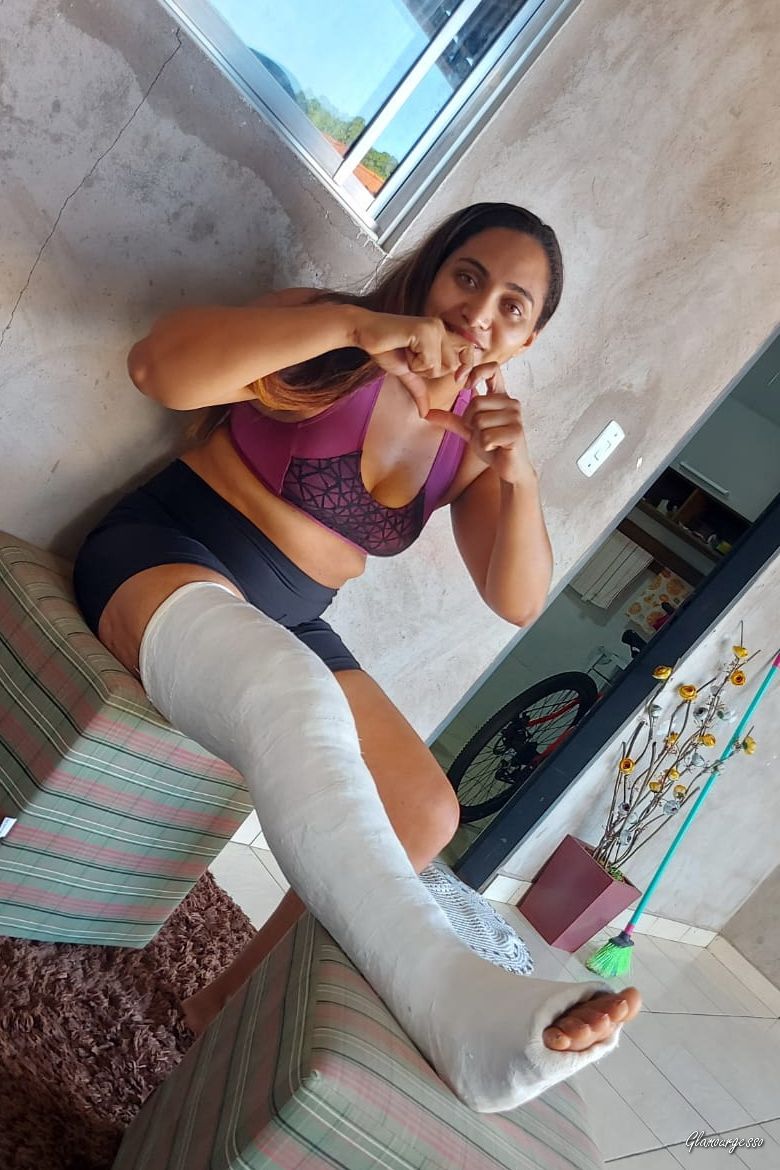 Nilda Medical LLC - VIDEO 02: Weeks 3-4 in cast
