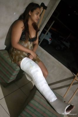 Nilda Medical LLC - VIDEO 01: Weeks 1-2 in cast