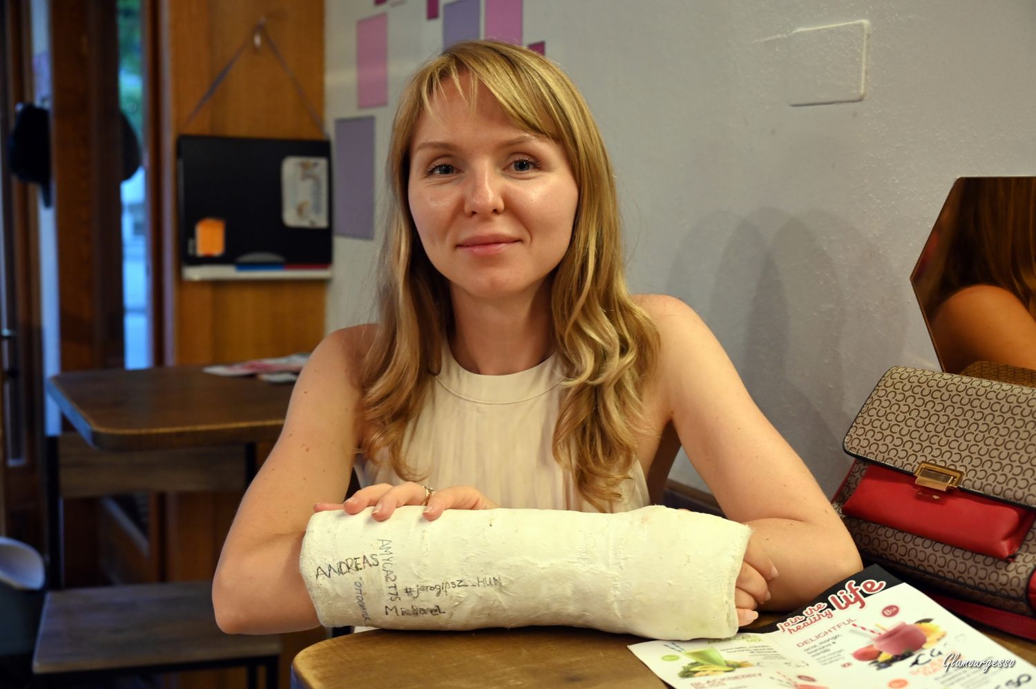 Svitlana Medical SAC - VIDEO 04: Days 10-12 in cast
