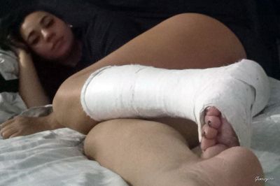 Hannah Medical SLC - VIDEO 03: Week 03 in cast
