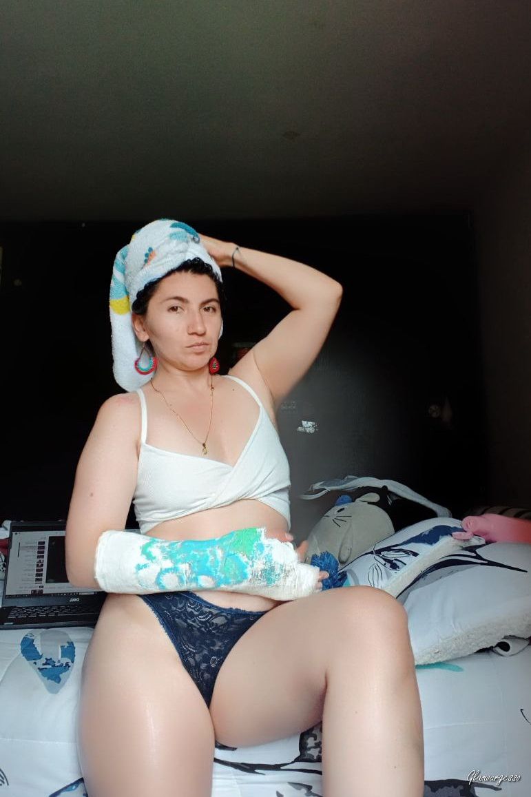 Paula Medical SAFS - VIDEO 05: Fifth week in medical cast