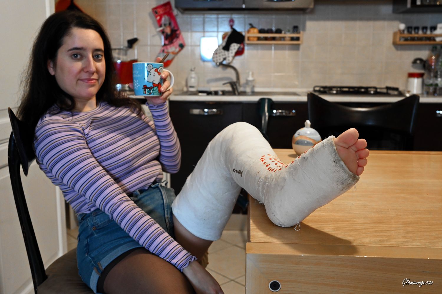 Susy LLC - VIDEO 05: Broken leg housewife