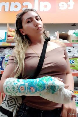 Paula Medical SAFS - VIDEO 06: Sixth week in medical cast