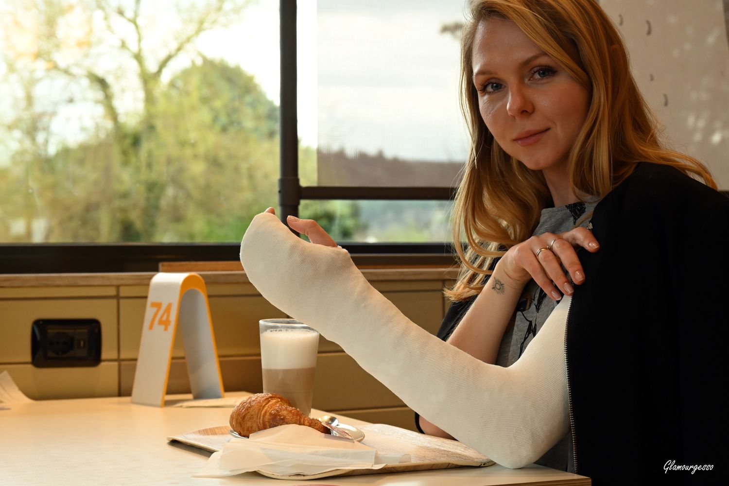 Svitlana LAFS - VIDEO 01: On trip with a broken arm