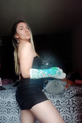 Paula Medical SAFS - VIDEO 07: Seventh week in medical cast