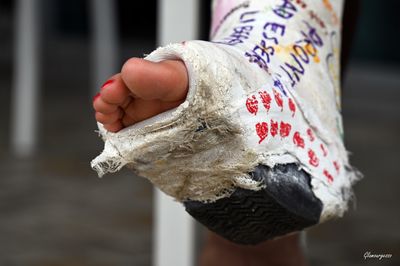 Svitlana SLWC - VIDEO 13: Ready for cast removal