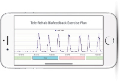Tele-Rehab Biofeedback Exercise Plan - Premier