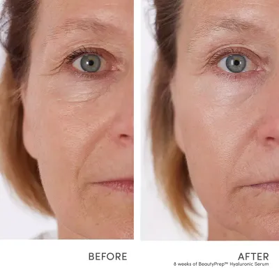 jane iredale Beautyprep Hyaluonic Serum