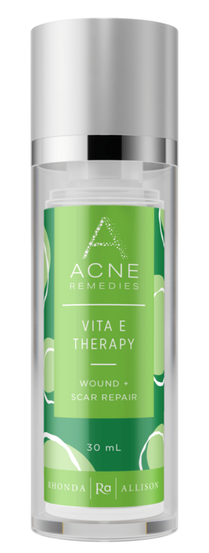 Rhonda Allison Vita E Therapy - Acne Remedies