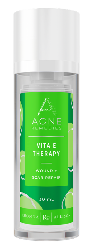 Rhonda Allison Vita E Therapy - Acne Remedies