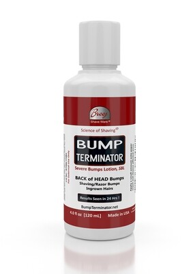 Bump Terminator Severe Bumps Lotion, 4 oz