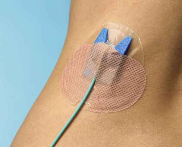 ME.CHKT01 - Chimed Drainage Bag Kit MS/00054LM [500ml] + Drain Guard 8150 - Free Delivery, VAT incl.