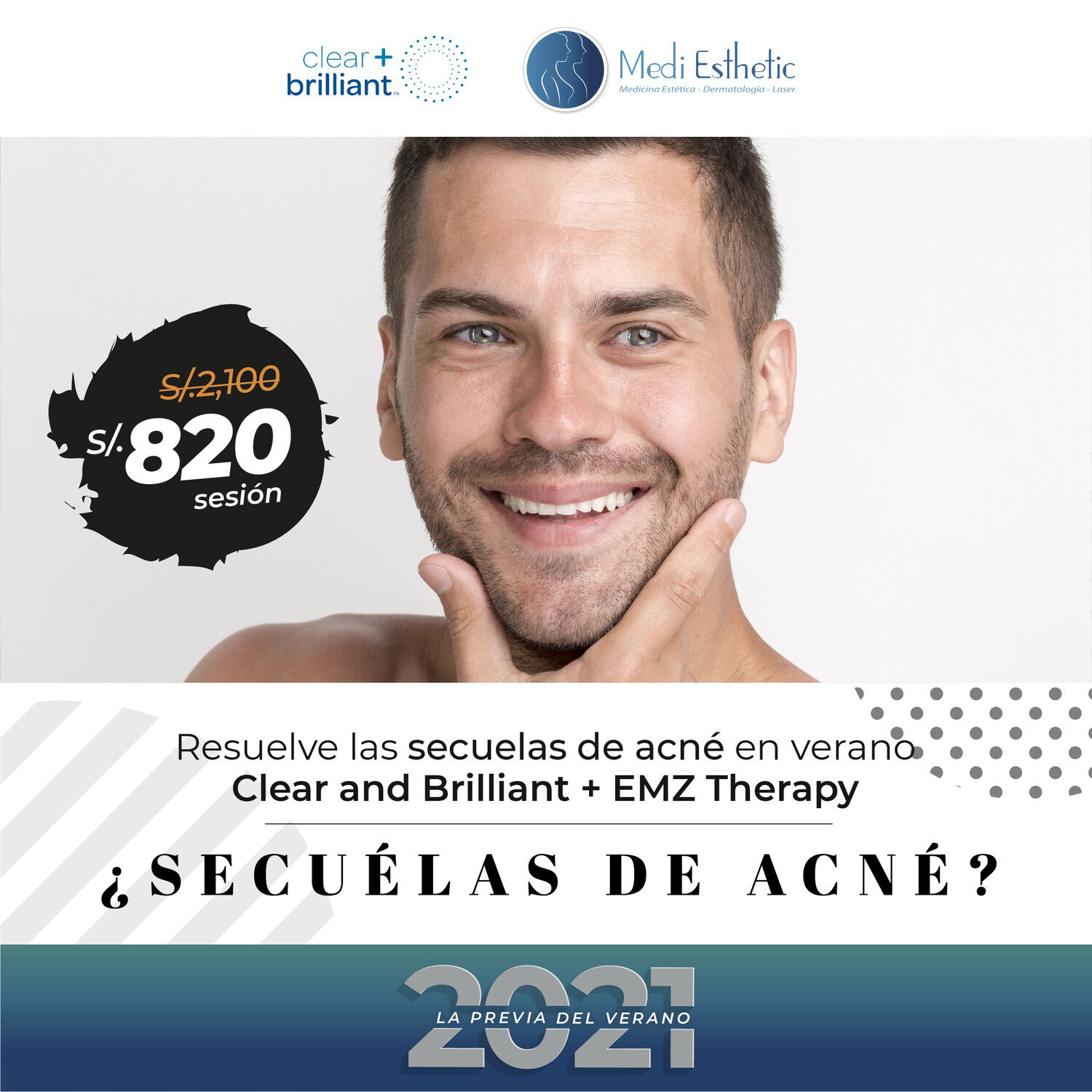 Secuelas de acné en verano Secuelas de acné en verano