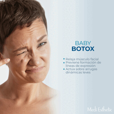 Baby Botox