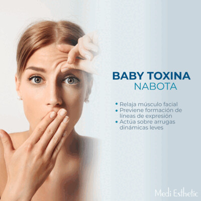 Nabota baby Toxina