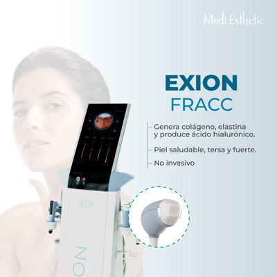 Exion Fracc