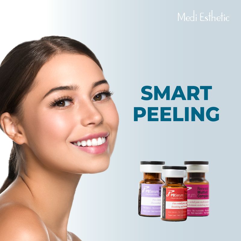 Smartpeeling