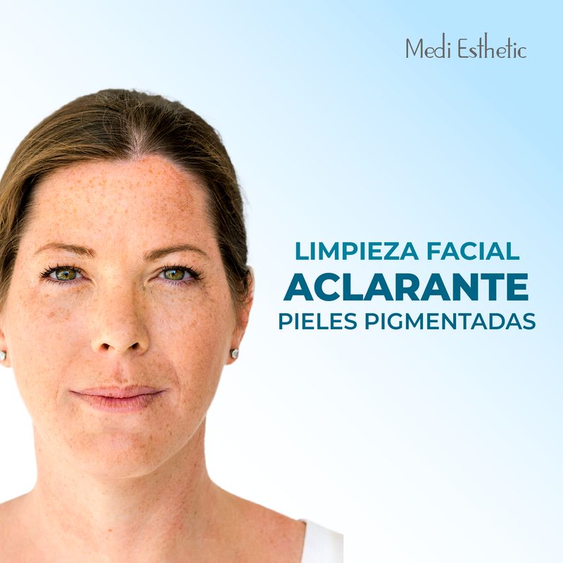 Limpieza aclarante