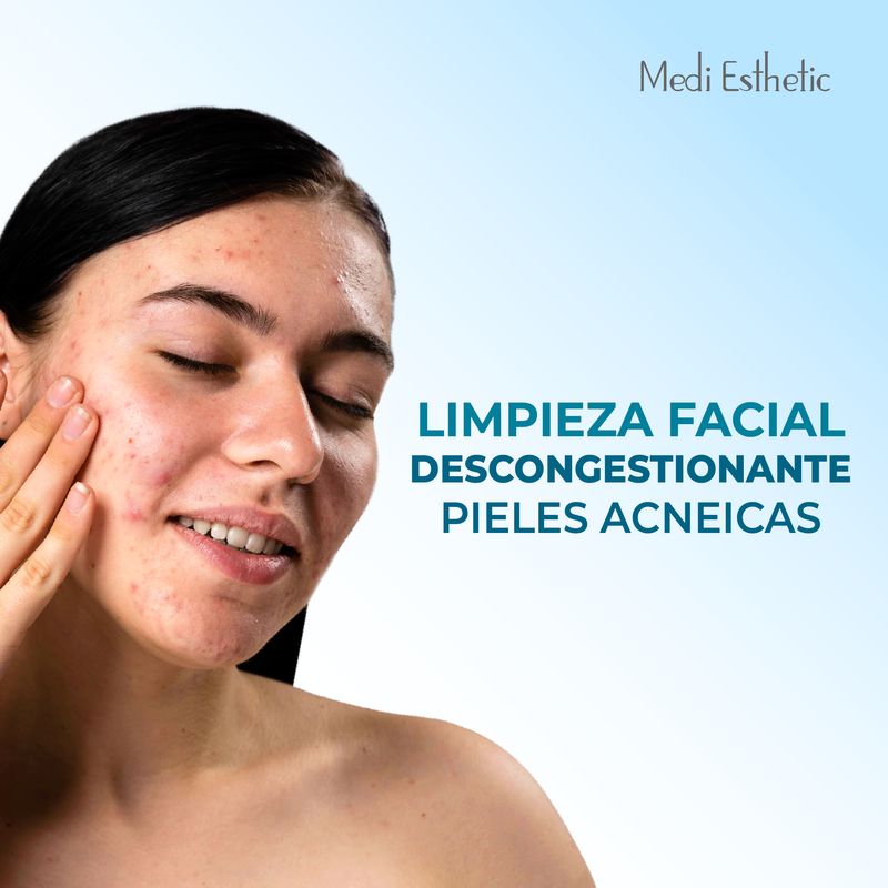 Limpieza Descongestionante