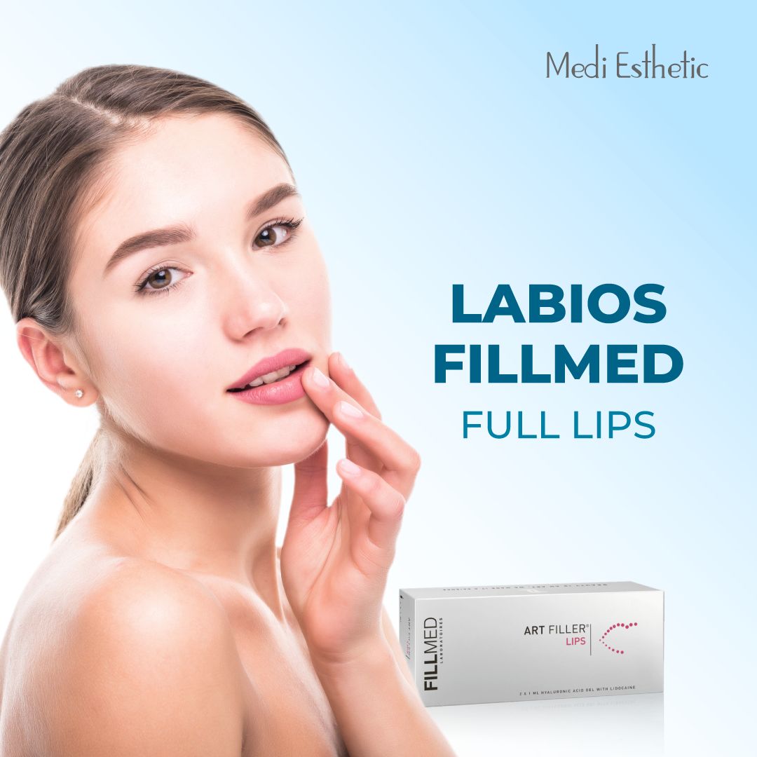 Relleno de labios