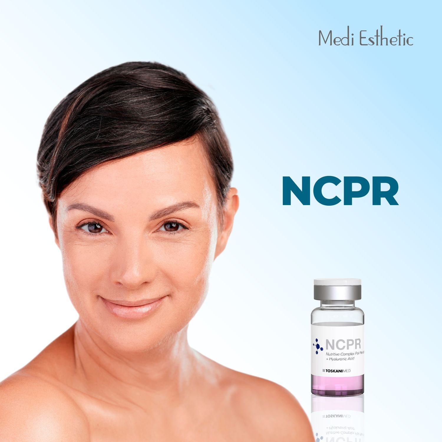 NCPR