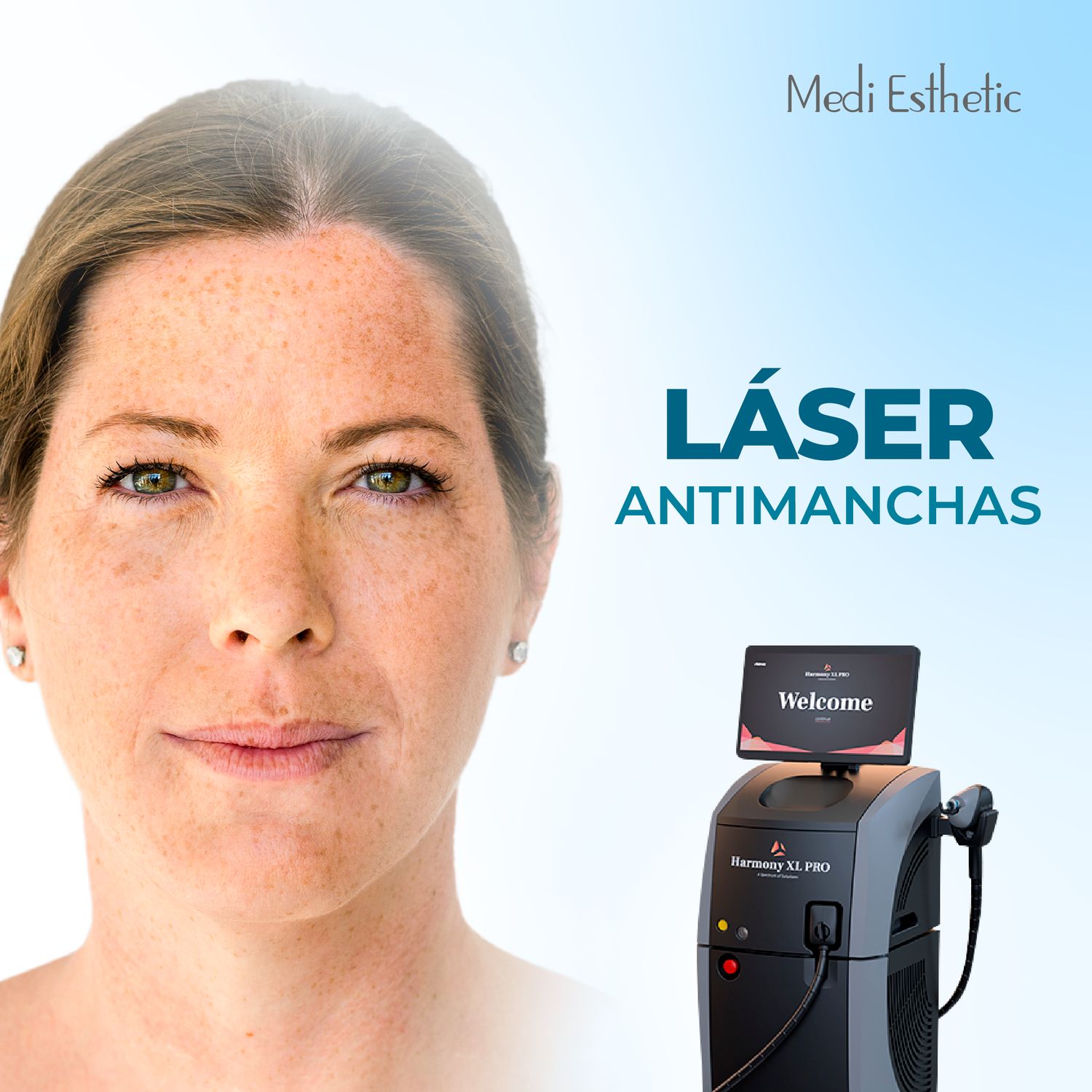 Láser Harmony manchas