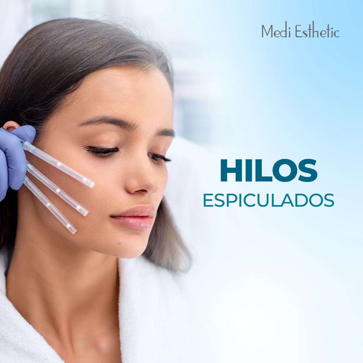 Hilos Espiculados