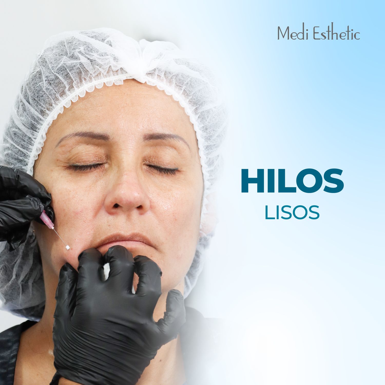 Hilos Lisos