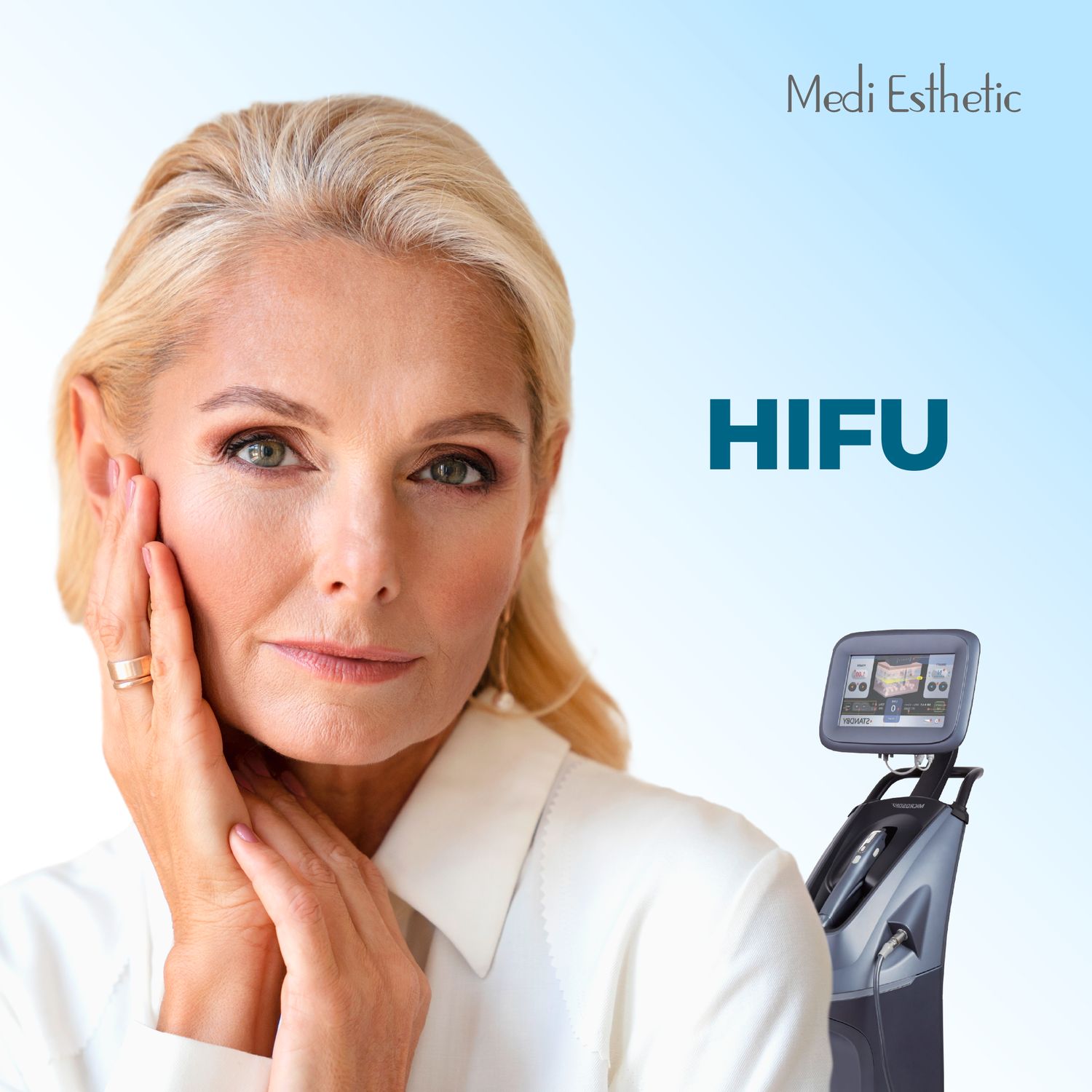 Hifu 1 zona