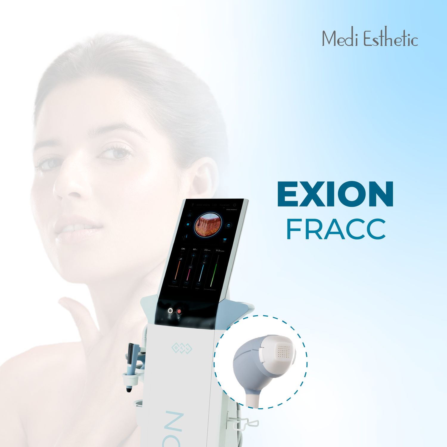 Exion Fracc