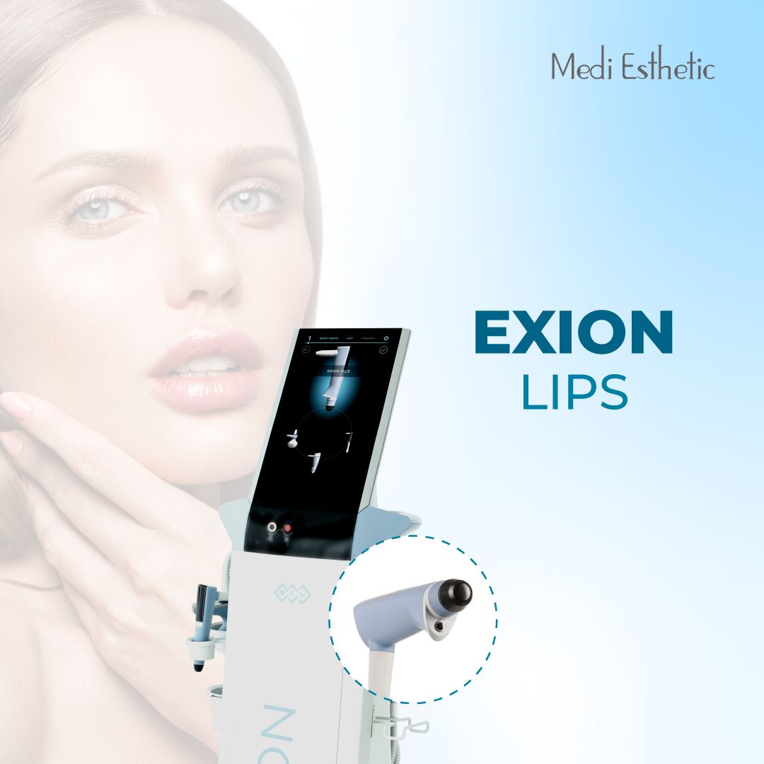 Exion Lips