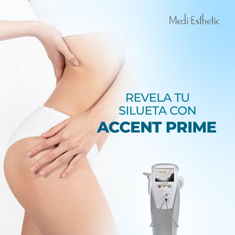 Accent Prime