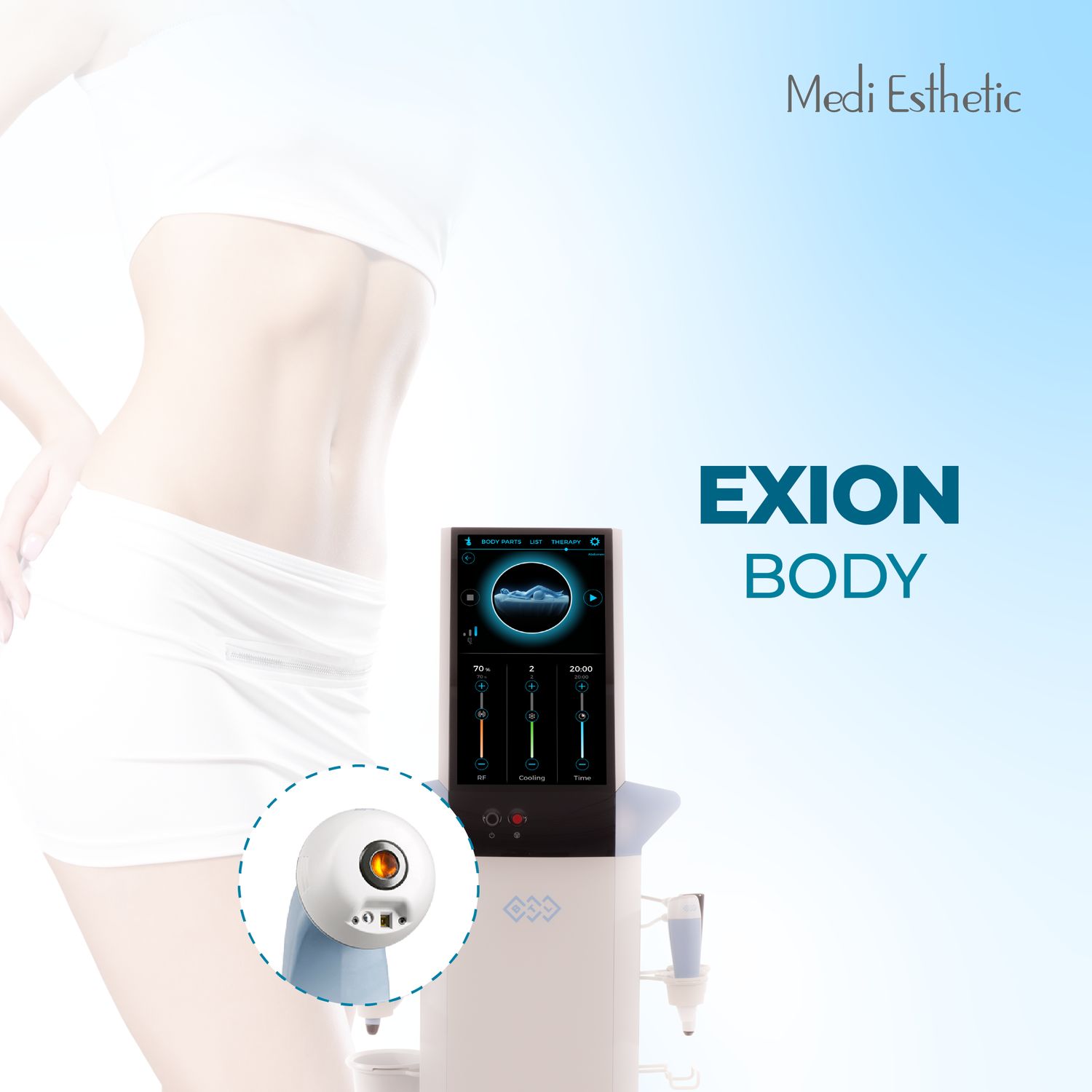 Exion Body