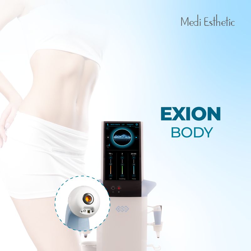 Exion Body