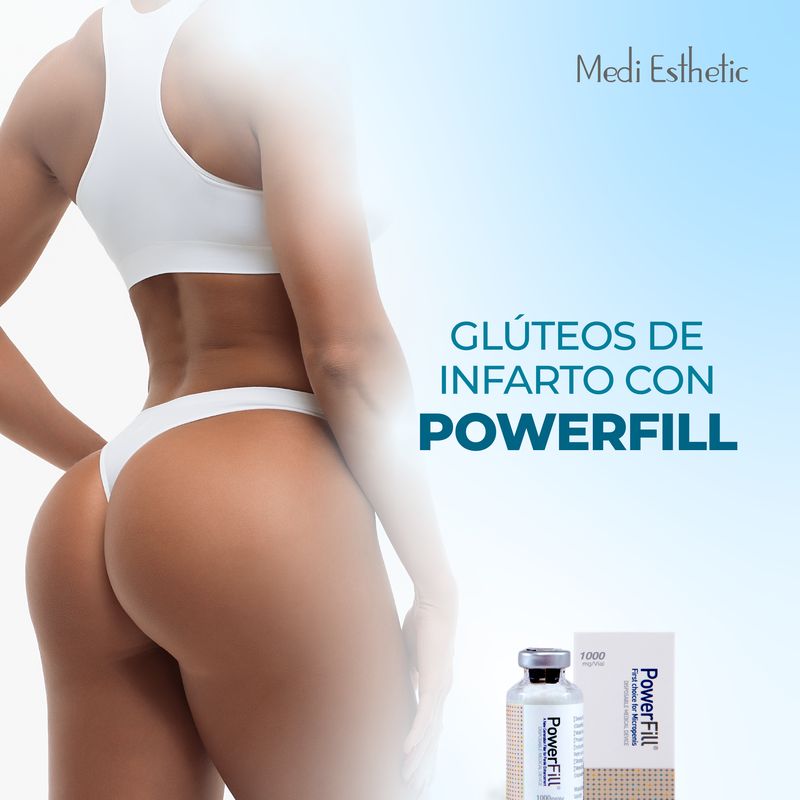 Powerfill