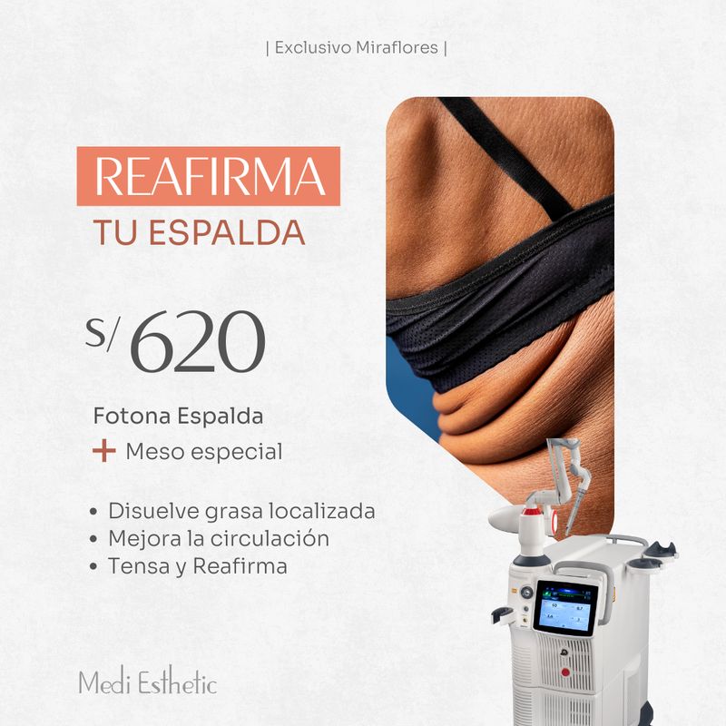 Reafirma tu espalda