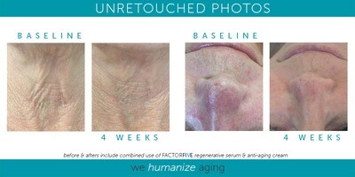 FactorFive Anti-Aging Cream