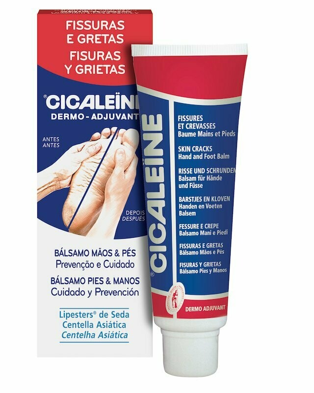 Cicaleine Fisuras y Grietas