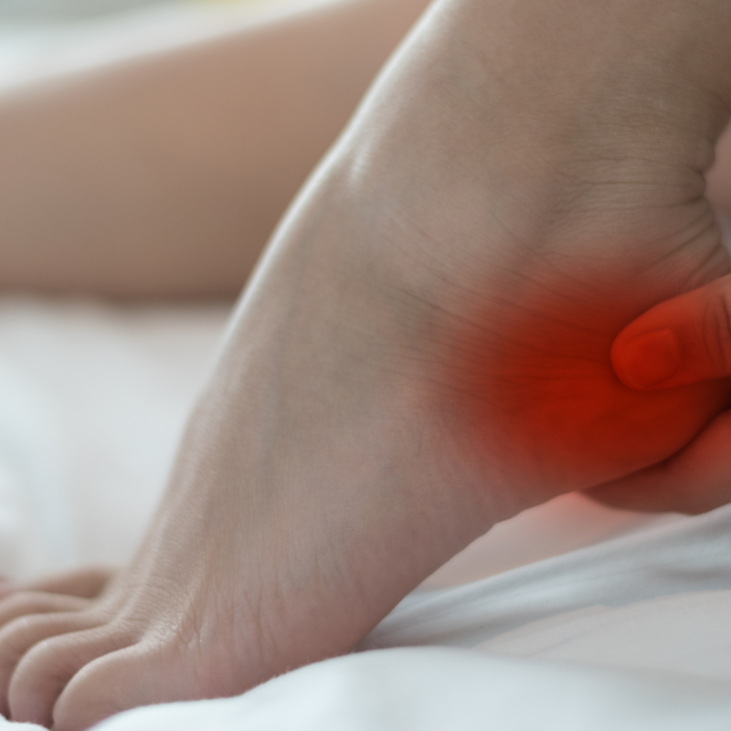 Tratamiento Fascitis Plantar