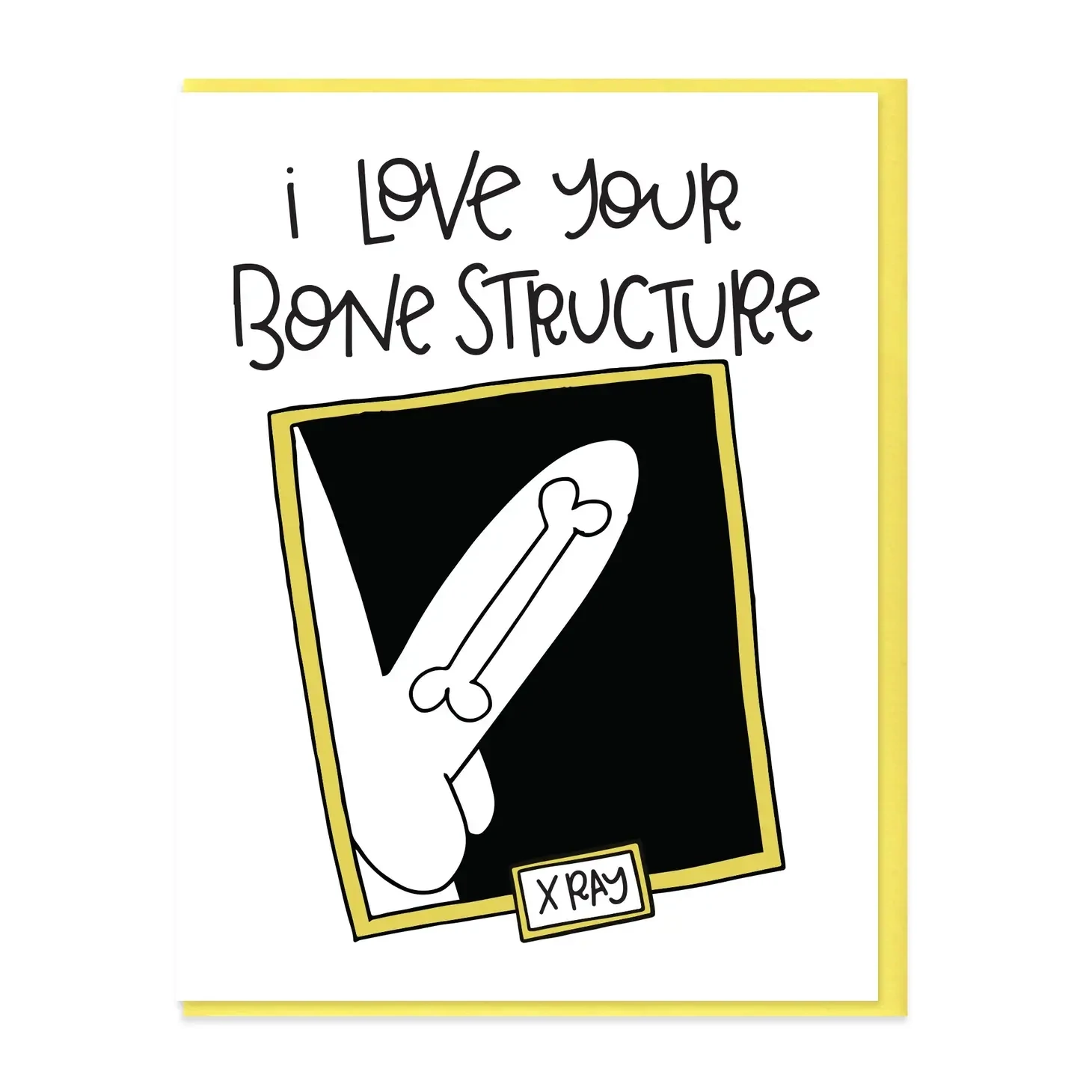 Bone Structure Card