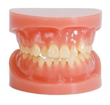 PREMIUM PLUS, (D-OS-SNB) ORTHODONTIC ABNORMAL MODEL