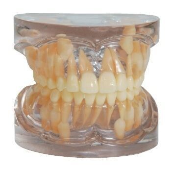 PREMIUM PLUS, (C-EV-Y9A) CLEAR MIXED DENTITION - AGE 9