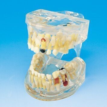 PREMIUM PLUS, (PE-TDS002) / (P12P-100R) UPPER/LOWER JAW MODEL