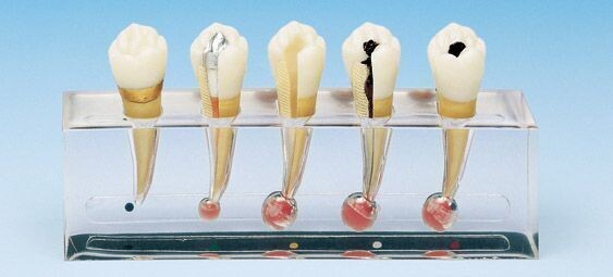PREMIUM PLUS, (PE-END002) / (P23-END.2) ROOT CANAL PROCEDURE MODEL
