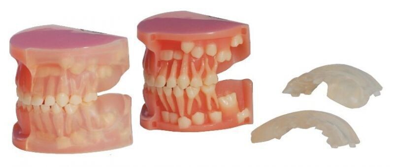 PREMIUM PLUS, (C-SM-DDD) DEVELOPING DENTITION - AGE 3 TO 6