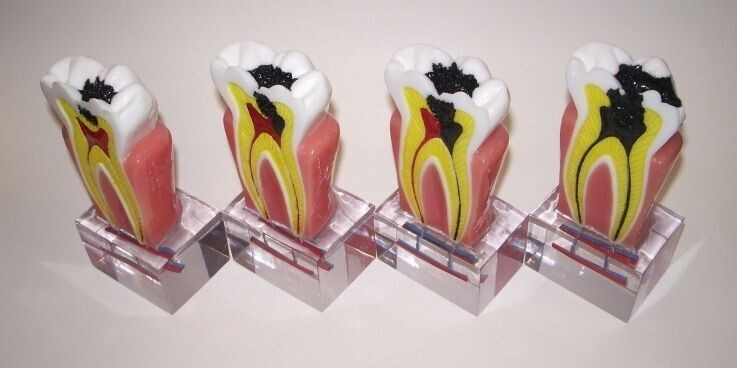 PREMIUM PLUS, (A-ED-L002) CARIES PROCESSING (4 PCS)