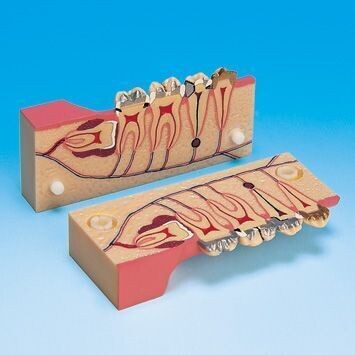 PREMIUM PLUS, (PE-TDS007) / (P13-TR.9) SAGITALLY SECTIONED MODEL