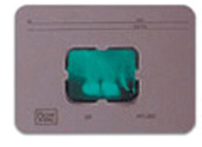 Greylight X-Ray Mounts 100/Pk 1H