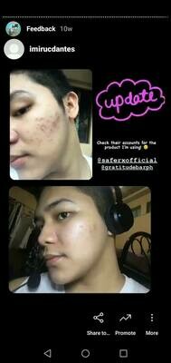 SAFERX Korean Serum Sunscreen, Serum Water, Serum Moisturizer and Serum Soap | FREE TRIAL KOREAN KIT by SAFERX KOREA | Customized Formula & Packaging | Safe & Effective | FDA Approved | 2+1 FREE