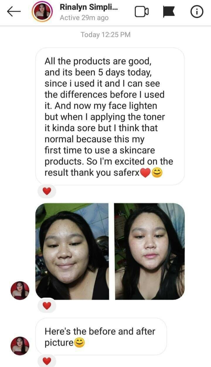 Korean Serum Night Cream, Soap, Serum Cleanser, Sunscreen, Whipp Soap | FREE TRIAL KOREAN KIT by SAFERX KOREA | Customized Formula and Packaging | Safe and Effective Ingredients | FDA Approved